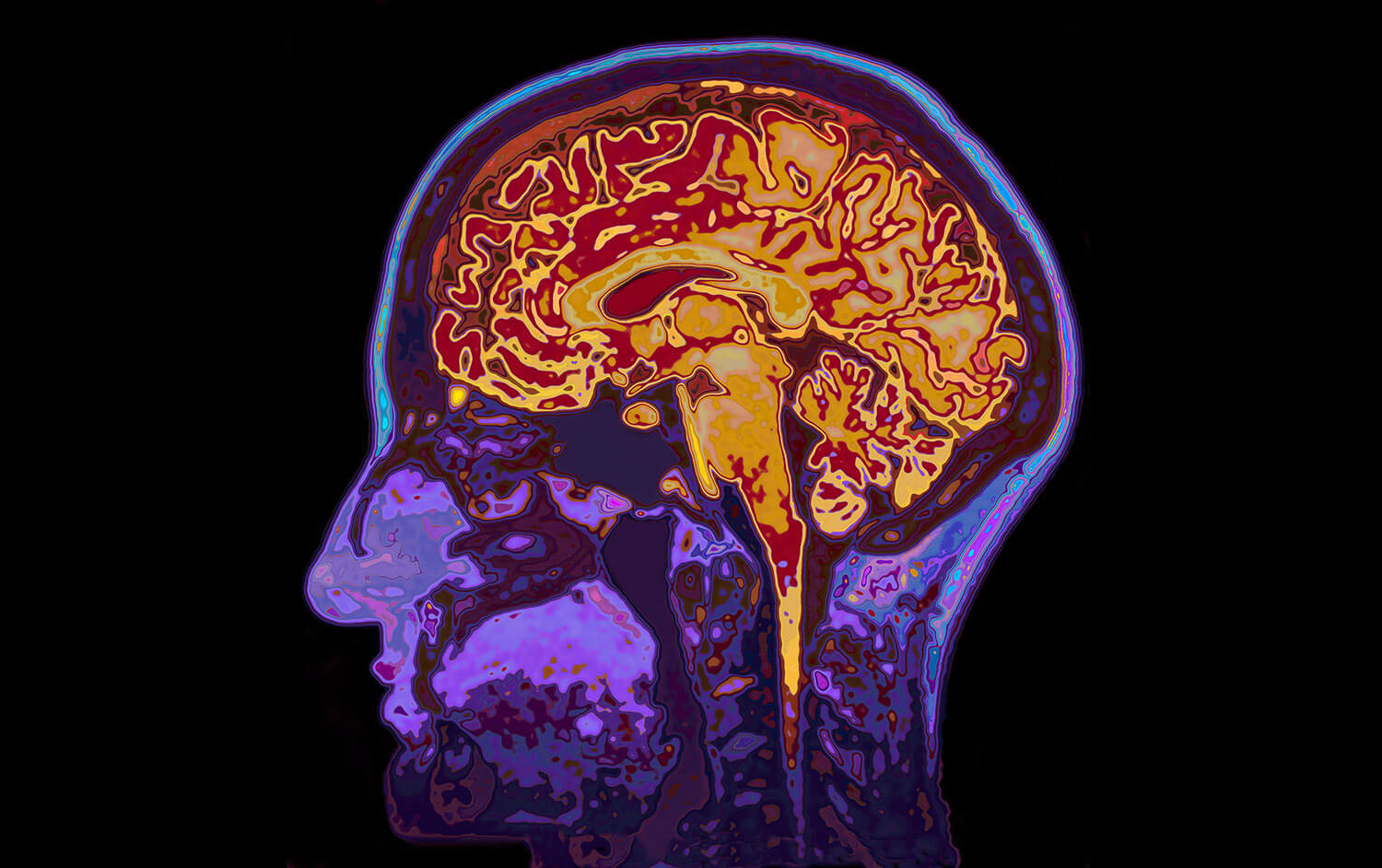 Basic psychedelic neuroscience
